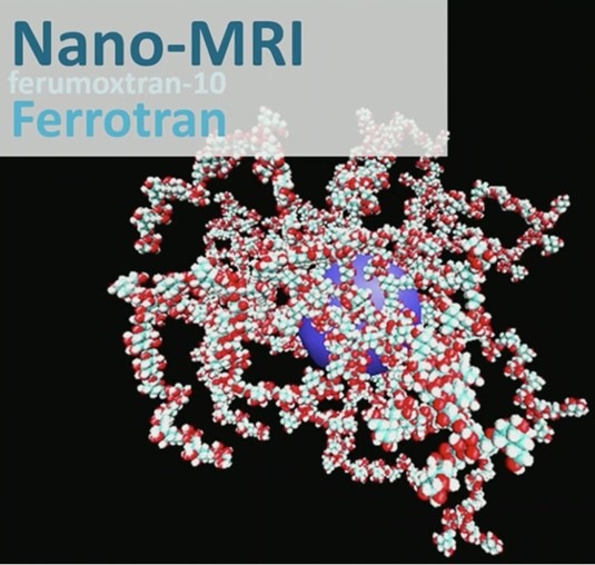 MRT-Kontrastmittel - was kommt nach Gadolinium / Ferrotran® (Ferumoxtran) für Imaging beim Prostatakarzinom / Imaging ohne Gadolinium in der letzten Phase der Zulassung