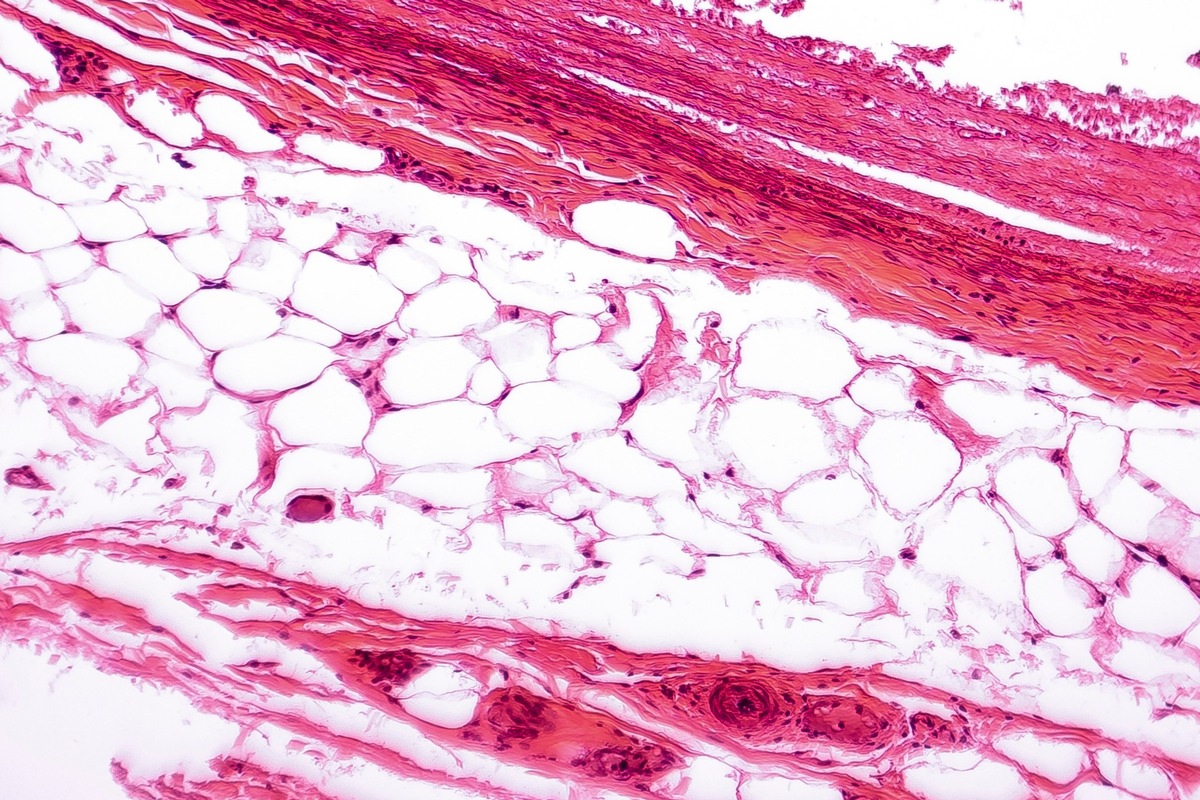 Neues Wissensportal Adiposetissue.org stärkt die Adipositas- und Stoffwechselforschung durch zentralisierte Daten