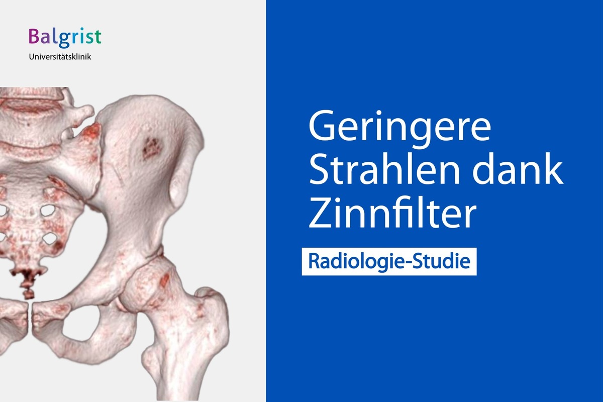 MEDIENMITTEILUNG --- Computertomographie: Geringere Strahlen dank neuem Standard