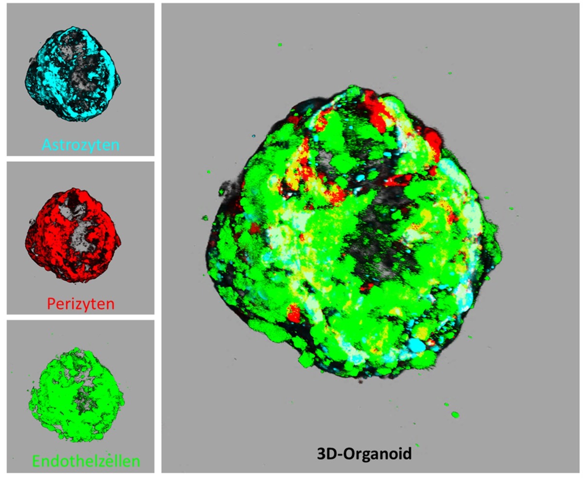 Schlaganfallforschung ohne Tierversuche: „Mini-brains“ statt Mausmodell