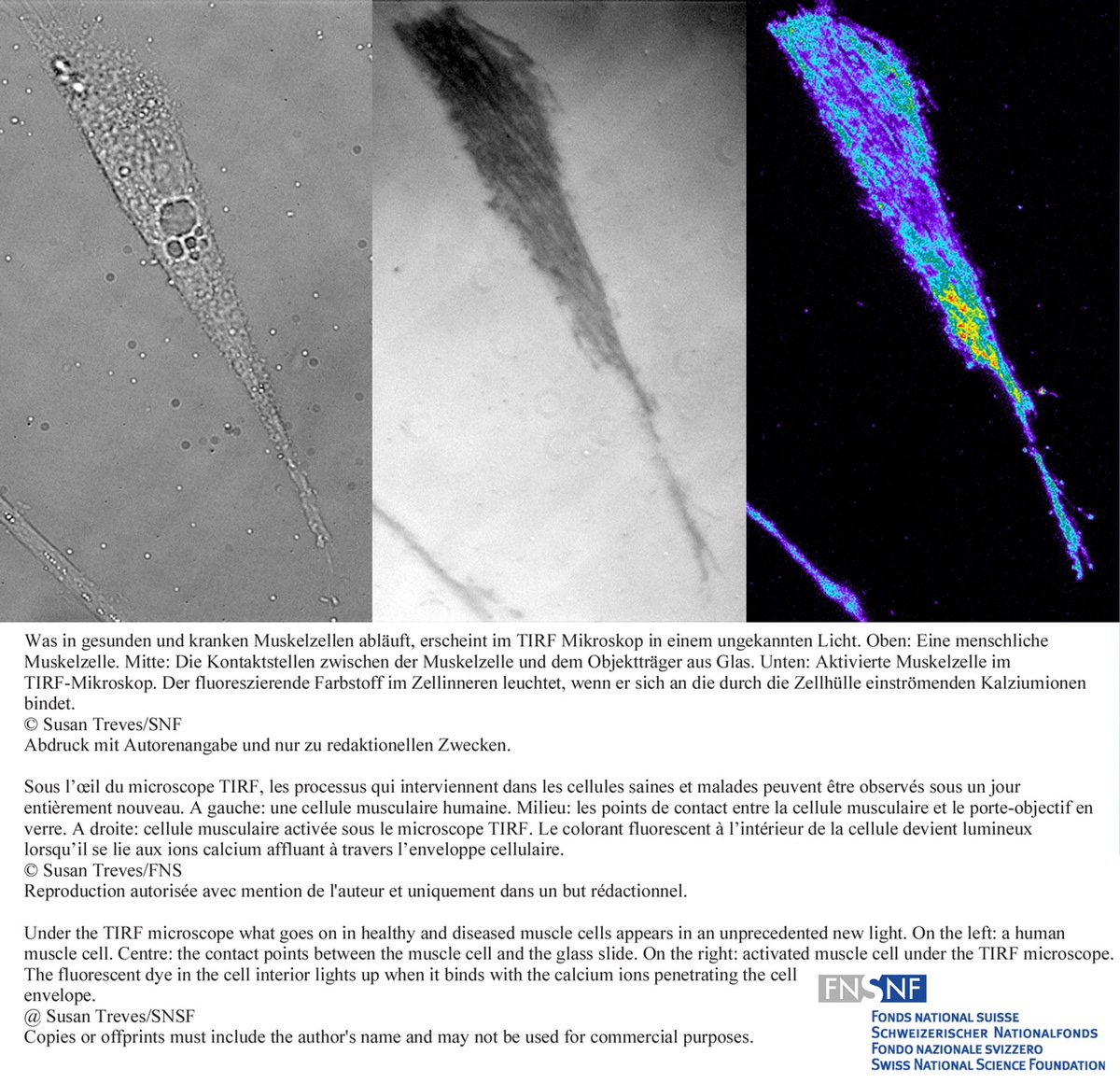 FNS: Image de la recherche: Un microscope nouvelle génération ouvre des perspectives inédites sur les cellules musculaires