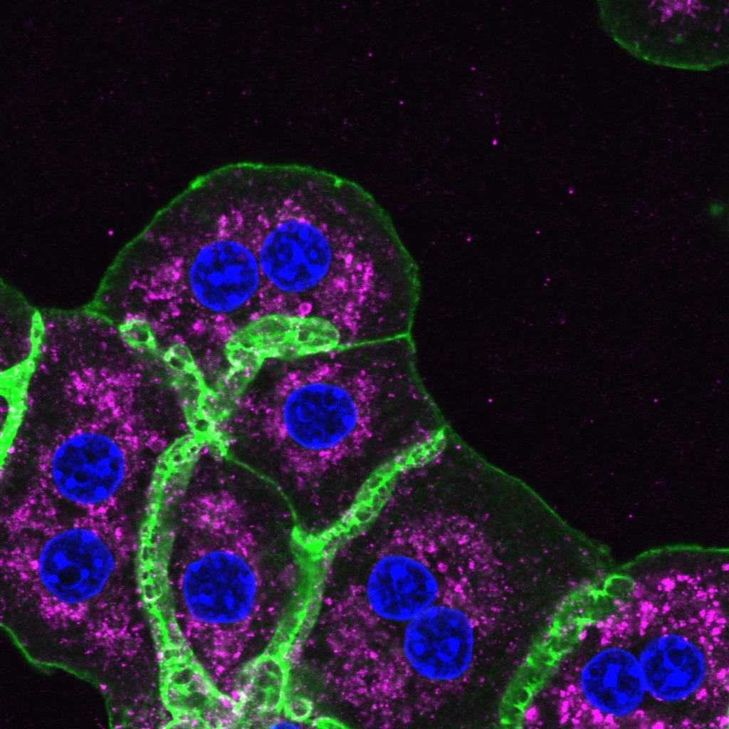 Switching tracks: Changing the trafficking of the glucagon receptor in the liver regulates its metabolic signaling