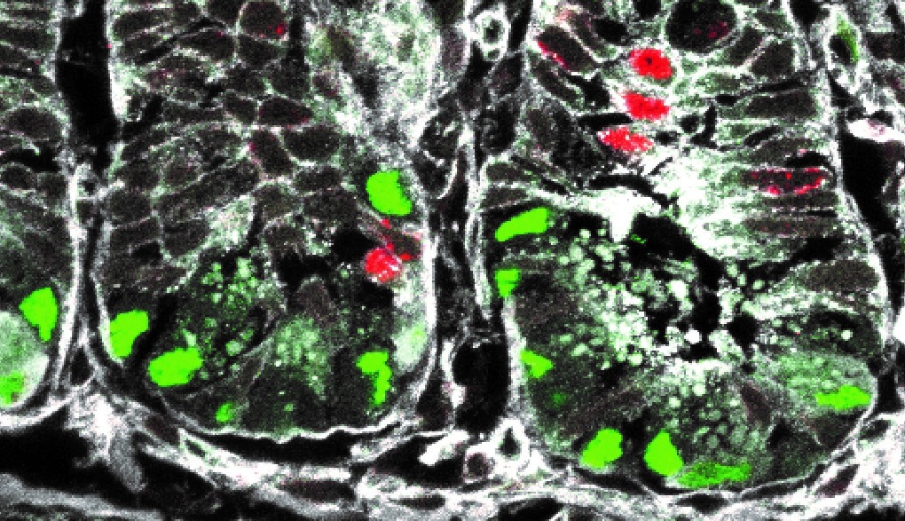 Stammzellen im Darm: Neue Erkenntnisse könnten Weg für die Behandlung zahlreicher Krankheiten ebnen