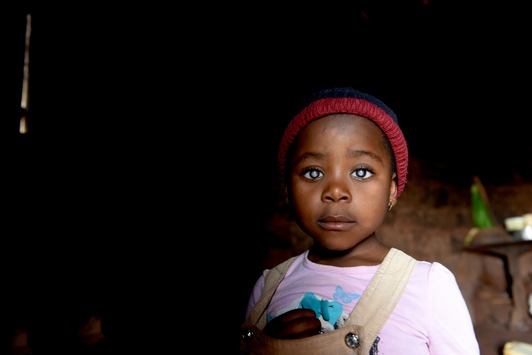 Das Wunder in Kindras Augen / Mit einer Grauen-Star-OP schenkt die CBM in den ärmsten Ländern unzähligen Kindern Augenlicht und die Chance auf ein besseres Leben