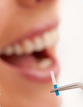 Lebenslang gesunde Zahnimplantate – Wunsch oder Wirklichkeit?